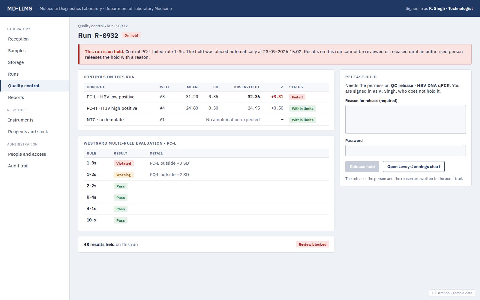 Illustration with sample data, not a capture of the software. MD-LIMS quality control screen showing a control that failed a Westgard rule and the run placed on hold.
